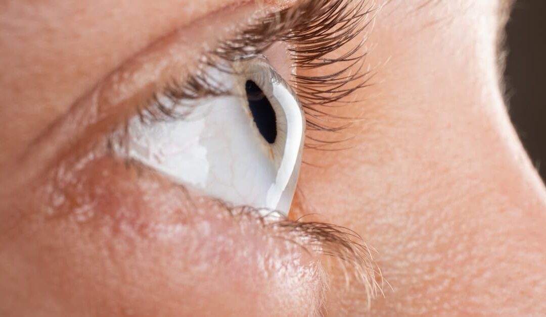 When Should You Consider Corneal Cross-Linking in Boise for Keratoconus?