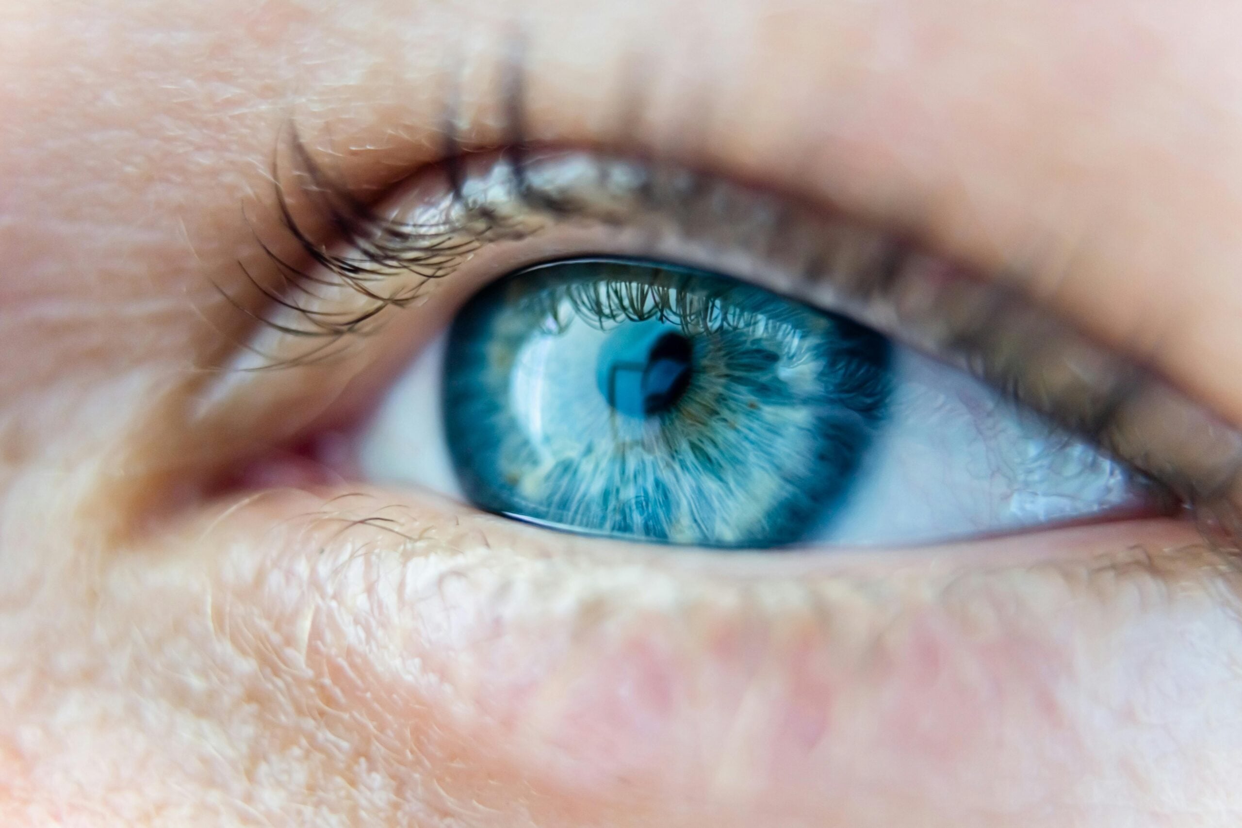 kamra inlay vision correction boise